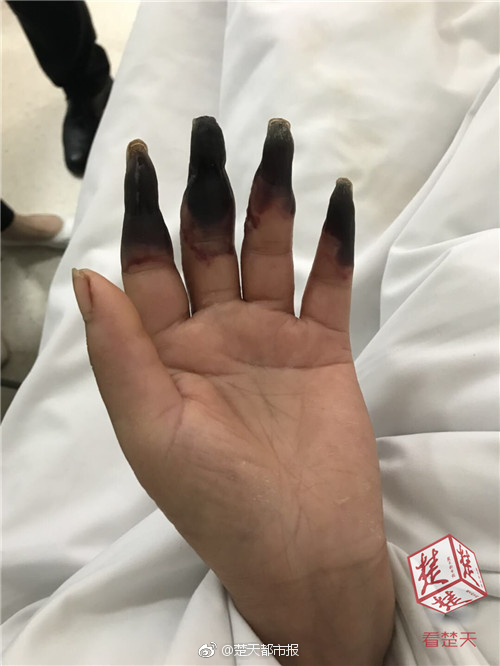 【52吃瓜】紅糖水中還有一些有機酸